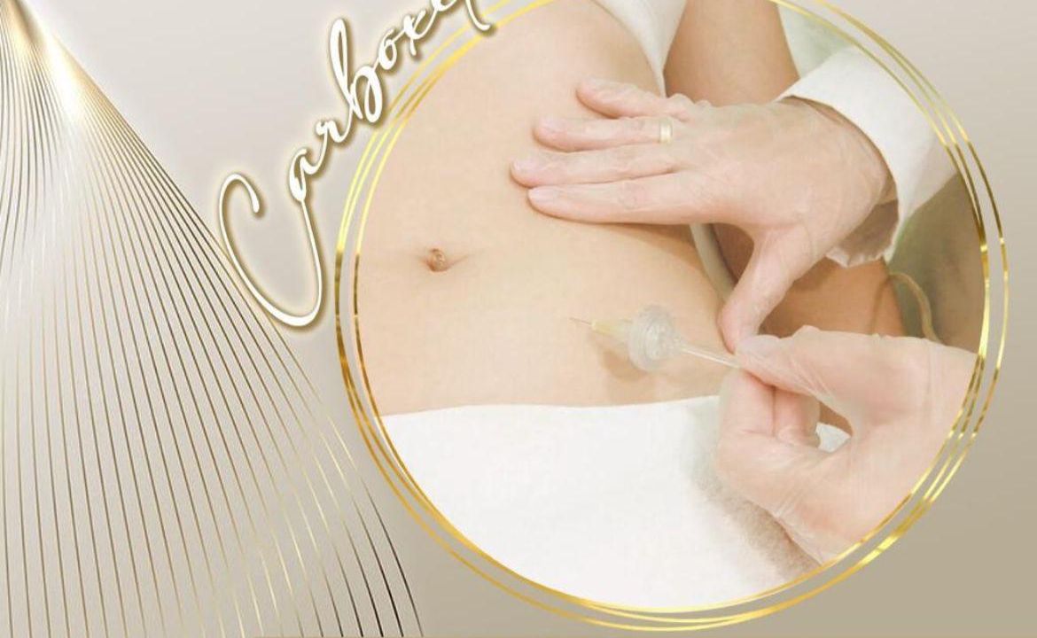 Imagem da estrutura da academia