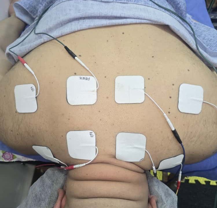 Imagem da estrutura da academia